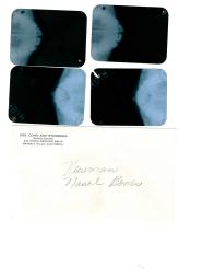 M・モンローが整形した「証拠記録」、来月に競売へ