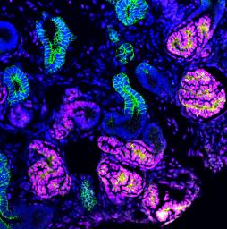 腎臓再生医療の扉が開いた! -熊本大、ヒトiPS細胞から3次元腎臓組織を作成