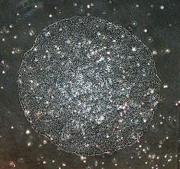 安全な培養法を確立 動物成分使わず 京都大iPS研