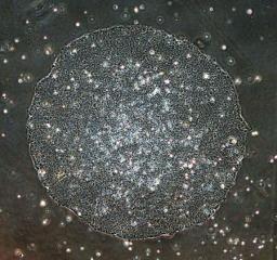 人工多能性幹細胞(iPS細胞)