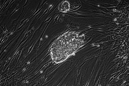 眠れる遺伝子を働かす化合物、京大 iPSに応用も