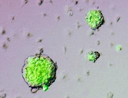 「夢のある研究成果」 STAP細胞作製成功に田村厚労相