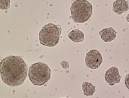 車椅子が要らなくなる? 「STAP細胞」で何が実現されるのか