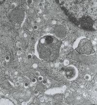 糖尿病関与の遺伝子解明=新薬開発に期待-京都府立医大