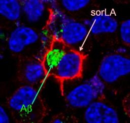 47NEWS ＞ 共同ニュース ＞ アルツハイマー防ぐ物質解明 脳内「掃除役」、大阪大