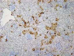 iPS血小板 臨床研究…京大など大量作製成功