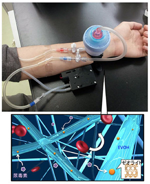 災害時の血液透析メッシュ開発