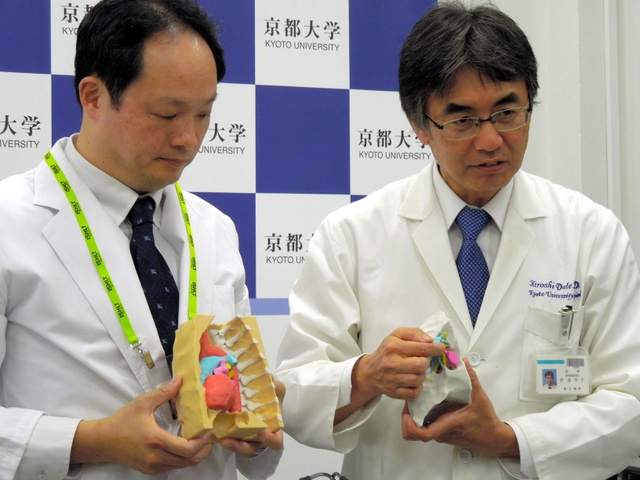 生体肺移植:夫の右肺、妻の左肺に移植 3Dプリンター模型が一役−−京大