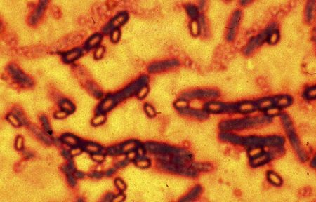 米ＣＤＣ職員７５人 炭疽菌に接触の恐れ