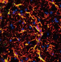 京大、ヒトiPS細胞由来グリア神経細胞をALSマウスに移植-生存期間延長を確認