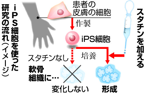 iPS細胞使えば薬・治療もテーラーメード!その人の病態・症状に合わせて開発