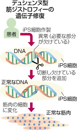 iPSで筋ジス遺伝子修復、京大 症状改善に光