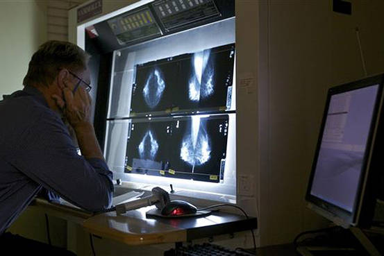 マンモグラフィー推奨４５歳に引き上げ…米指針 2015年10月22日 12時30分