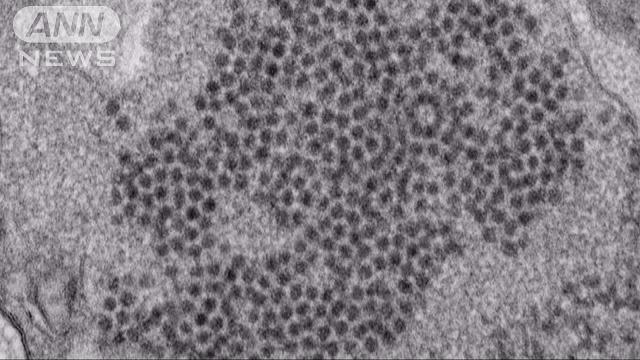 発熱後に手足まひ、「エンテロウイルス」検出 2015年10月29日 20時49分