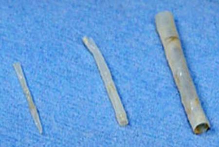 ０．６ミリの人工血管開発＝世界で最も細く—国循センター