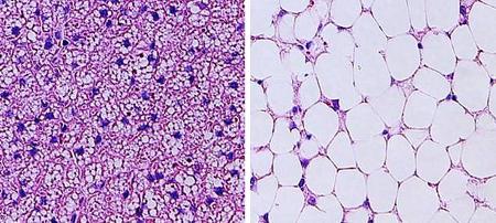 脂質燃やす細胞活発化の新経路、広島大が発見 肥満治療に期待