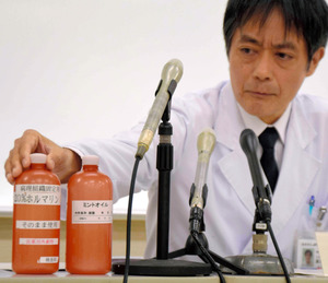 内視鏡検査で薬剤誤り胃に炎症 長野・松本市立病院