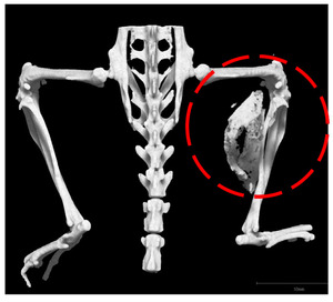 ｉＰＳ細胞使い難病の原因分子を特定 京大など
