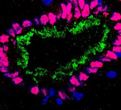 ｉＰＳで効率良く気道細胞 - 気管支ぜんそく解明期待