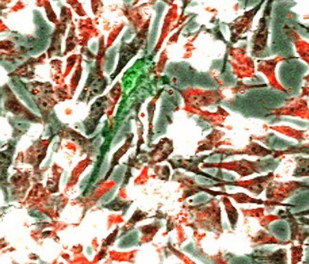 京大、iPSの元になる新細胞を作製 創薬研究に貢献