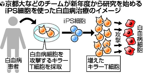 白血病治療に 京大など、免疫細胞を作製へ