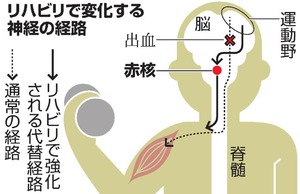 脳出血まひ、回復の「道」判明 リハビリ積むと代替神経