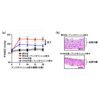 原因物質を特定、降圧剤開発に期待 生理研