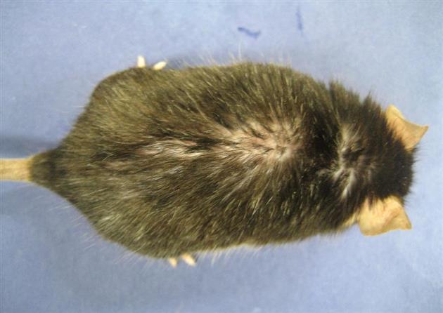 たんぱく質減少が原因 東京医科歯科大解明