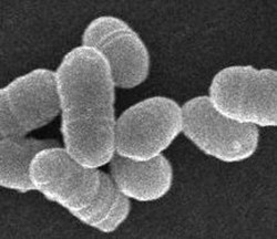 虫歯菌が脳出血に関与か…国立循環器病センター