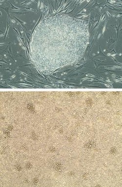 iPSで免疫活性化細胞=がん治療に応用期待-京大