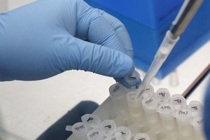 [FISCO]中国初のジカ熱患者確認、東莞の男性会社員がベネズエラ感染