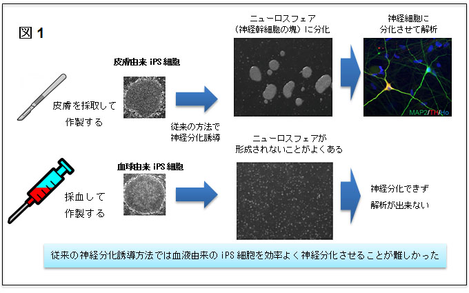 パーキンソン病解明へ「iPS細胞バンク」整備 順大と慶大