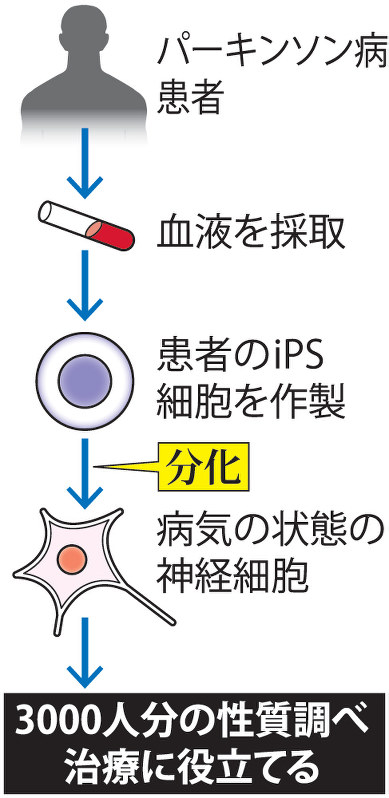 パーキンソン病ｉＰＳバンク設立へ…順大・慶大が新手法