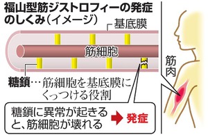 筋ジス原因、新たに発見＝治療法へ応用期待－神戸大など