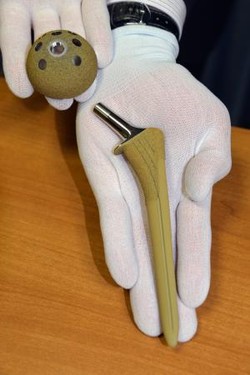 抗菌力高めた人工関節を開発 - 手術後の感染症防ぐ効果期待