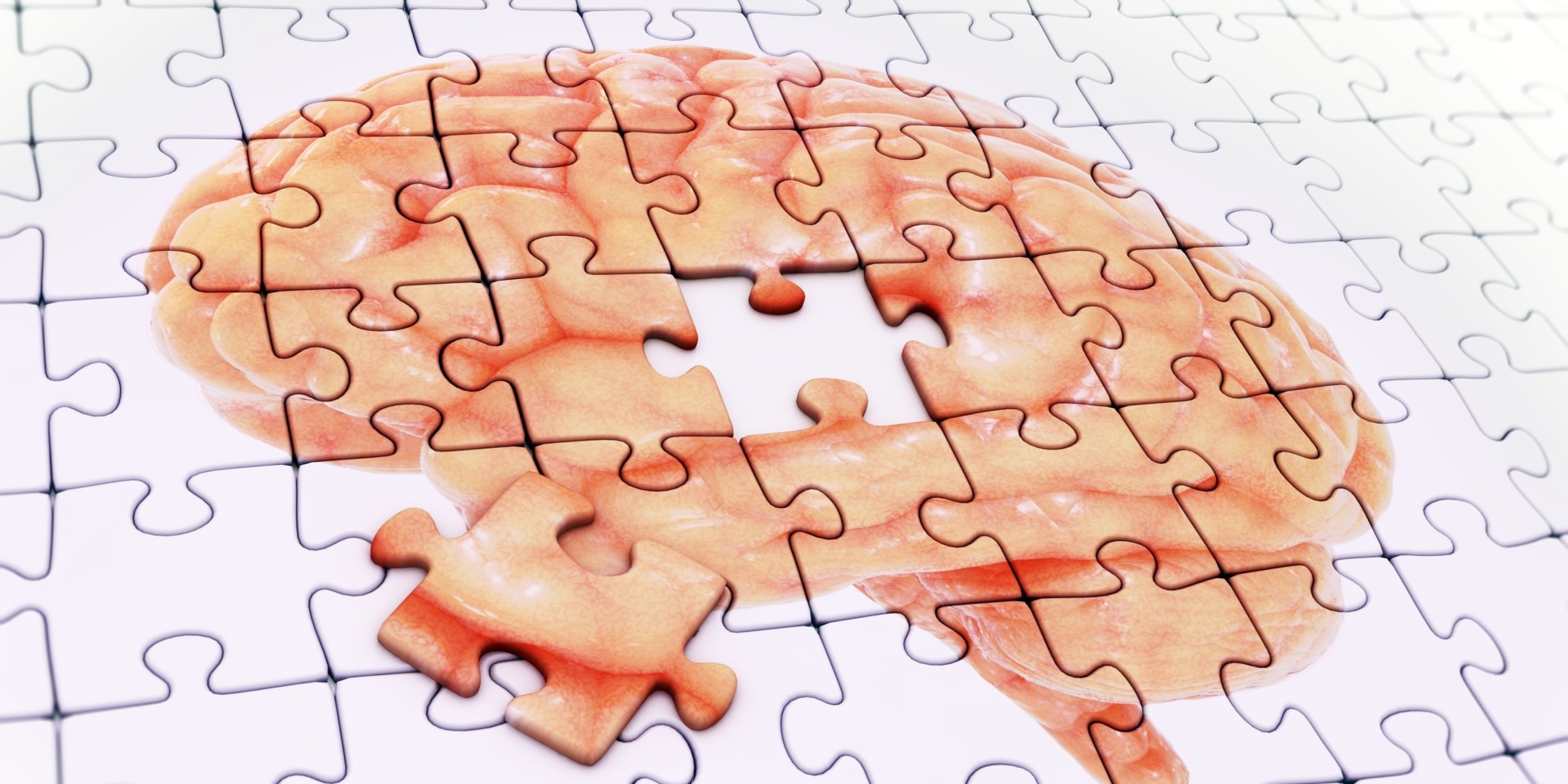 アルツハイマー病マウスの記憶取り戻す 利根川進氏らのグループが成功