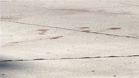 ひき逃げ容疑で弁護士逮捕 バイクの男性重傷