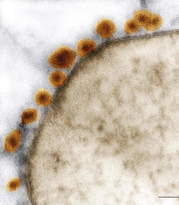 ジカウイルスで脳細胞死滅…小頭症との関連探る 2016年04月12日 00時12分