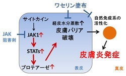 アトピー性皮膚炎の原因遺伝子、理研など研究チームが解明 薬による予防法も