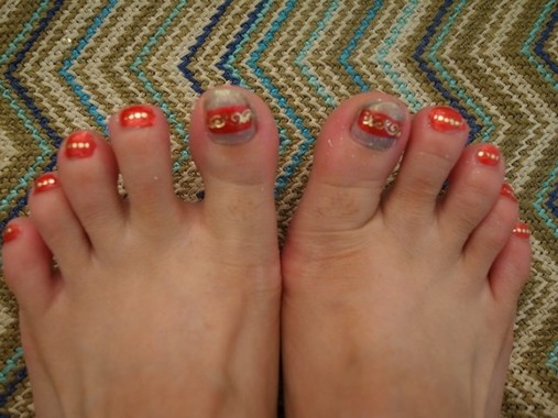 【男と女の相談室】「水虫なんてオヤジの病気」は大間違い 若い女性に多い「爪をボロボロにする」カビ